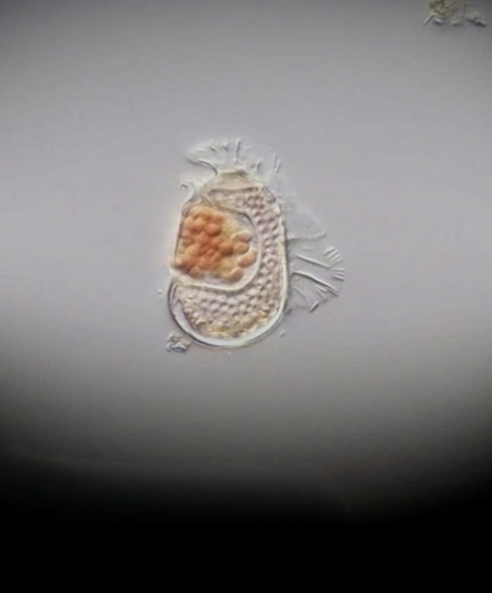 Sukunaarchaeum mirabile: archea na hranici života, která mění definici živé buňky