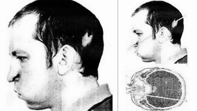 Historická fotografie Anatolije Bugorského po nehodě a vizualizace průletu svazku